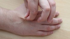 Lékař popisuje snadný test s kůží. Za pár vteřin může odhalit dehydrataci