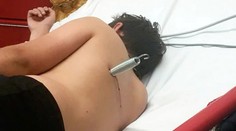 Hra na trampolíně se změnila v horor! Chlapec skončil s pružinou v zádech