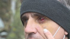 Brutální útok lopatou! Tři neznámí pachatelé na Liberecku zmlátili muže