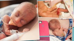 Ženě umřelo předčasně narozené dítě, tak začala fotit ostatní