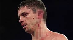 Soupeř rozpůlil Smithovi ucho. Takhle vypadá boxer dnes! FOTO