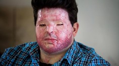 Chtěl pomstít příbuzného a polil muže kyselinou. Spletl si ale dům