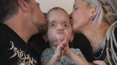 Emilek (3) trpí vzácným syndromem. Deformuje mu lebku, má za sebou spoustu operací