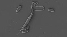 Český parazit má neobvyklý DNA kód. Je jako diktát nepozorného žáka, řekl biolog