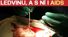 Transplantovali mu ledvinu, a s ní i AIDS