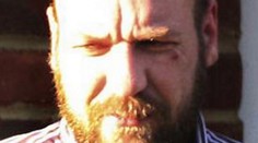 Zubař nakažený HIV léčil lidi a nic jim neřekl