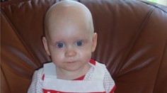 Malinká bojovnice Madlenka: V půl roce jí zjistili leukémii, díky andělům je jí lépe