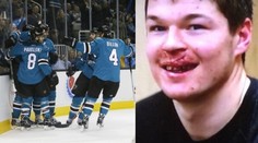 Hertl dostal pukem do obličeje a nedohrál, Frolík asistoval