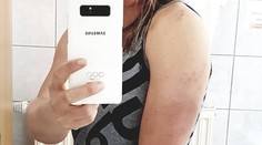 Ledecká zveřejnila šokující foto po Velikonocích! Takhle dopadla