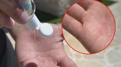 Pozor na dezinfekci! Na sluníčku vám může i ublížit