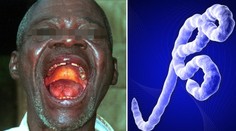 Strach z masivní nákazy: SMRTÍCÍ EBOLA mutuje do nové podoby