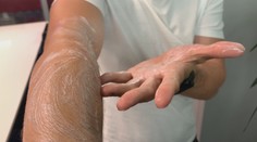 Konec upatlaných rukou od krému. Trik, který oceníte při opalování