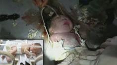 HOROROVÉ VIDEO! Matka (22) spláchla dítě a tajně se dívala, jak ho vysekávají z potrubí