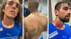 Hráči Marseille po konfliktu s fanoušky: Rány na krku i zádech