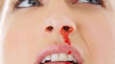 Dívka (16) z Kladrub si nic nepamatuje. Jak se zranila, zůstává záhadou