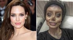 Měla vypadat jako Angelina Jolie. Takhle po 50 operacích dopadla!