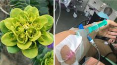 Pozor na tuto rostlinu na zahradě. Žena skončila na kapačkách