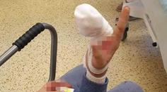 Malý chlapec si na koloběžce zranil ruku, utržený prst našli v parku