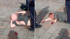 Polonahý agresor útočil na strážnici, skončil se zkrvavenou hlavou!