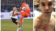 Faul roku! Brankář v bundeslize podrážkou ocejchoval útočníka