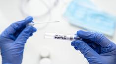 Tyto firmy dostaly nejvíce za testy na covid. Pojišťovny už vyplatily miliardy