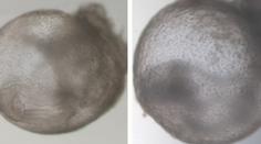 Přelom ve vědě. Výzkumníci vypěstovali první umělé embryo bez spermie i vajíčka