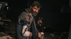 Šokující fotografie ukrajinského zajatce. Ztratil 30 procent váhy