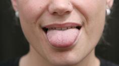 Co všechno můžete vyčíst z jazyka? Důležitá je barva a tvar