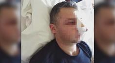 Mladík měl brutálně zbít hasiče. "Myslel, že je otravuje," tvrdí otec