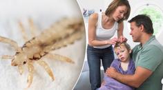 Školky zamořily vši! Zbavte se jich pomocí zaručených babských rad