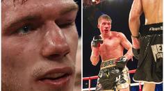 Hrozivý pohled: Boxer skončil s krvácením do mozku v kómatu!