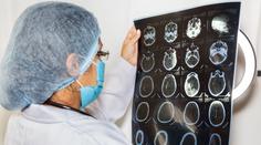 Lidé často podceňují příznaky zákeřné nemoci. Lékaři před ní důrazně varují