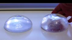 Přibývá žen s nemocí prsních implantátů. Pomohla až další operace, říkají