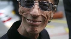 Robin Gibb z Bee Gees zemřel. Zabila ho rakovina