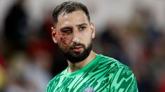 Deset stehů a nucená pauza. Hvězda PSG kurýruje děsivé zranění ze šlágru