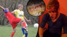 HRŮZA! Anglického fotbalistu napadli v Rumunsku sekerou!