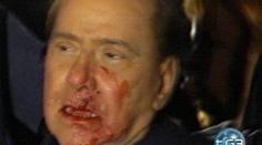 Berlusconi je po K.O. bez zubů. Poleží si v nemocnici