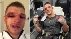 Poirier s Hookerem stanovili nový UFC rekord! Takhle dopadli po zápase