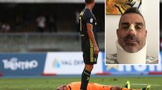 První zářez CR7 v Serii A: Gólman v bezvědomí se zlomeným nosem!