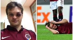 HOROR na Spartě: Pulkrabovo oko zmizelo v krvi! Co řekli lékaři?