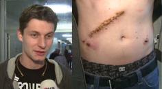 Pilát ukázal děsivou JIZVU! Řidítka mu propíchla i játra