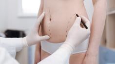 Sen o dokonalých křivkách: Vše o liposukci a tvarování těla