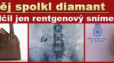 Zloděj spolkl kradený diamant. Usvědčil jej rentgenový snímek