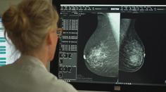 Mamograf snižuje úmrtnost na rakovinu o třetinu. Některé ženy ale vyšetření ignorují