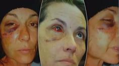 VIDEO: Policista mrštil s ženou o podlahu, až jí praskla lebka! Nebyl potrestán