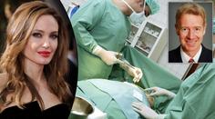 Angelina nemusela přijít o bradavky, prozradil expert na rekonstrukce prsou