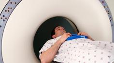 Přelomový objev v léčbě rakoviny: Chemoterapie bude brzy minulostí