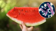 Hygienici varují: Melouny mohou způsobit i úplavici, na tohle pozor!