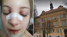 Pád dívky (8) ve škole vyšetřuje policie! Podle matky mohla zemřít