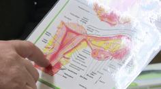 Rakovina děložního čípku zabije stovky žen ročně. Důležitá je prevence a očkování